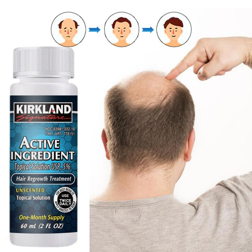 6 Months Kirkland Liquid for hair treatment by Kirkland Signature