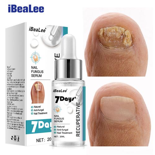 iBeaLee 7 Days Nail Fungus Serum Nail Repair Liquid
