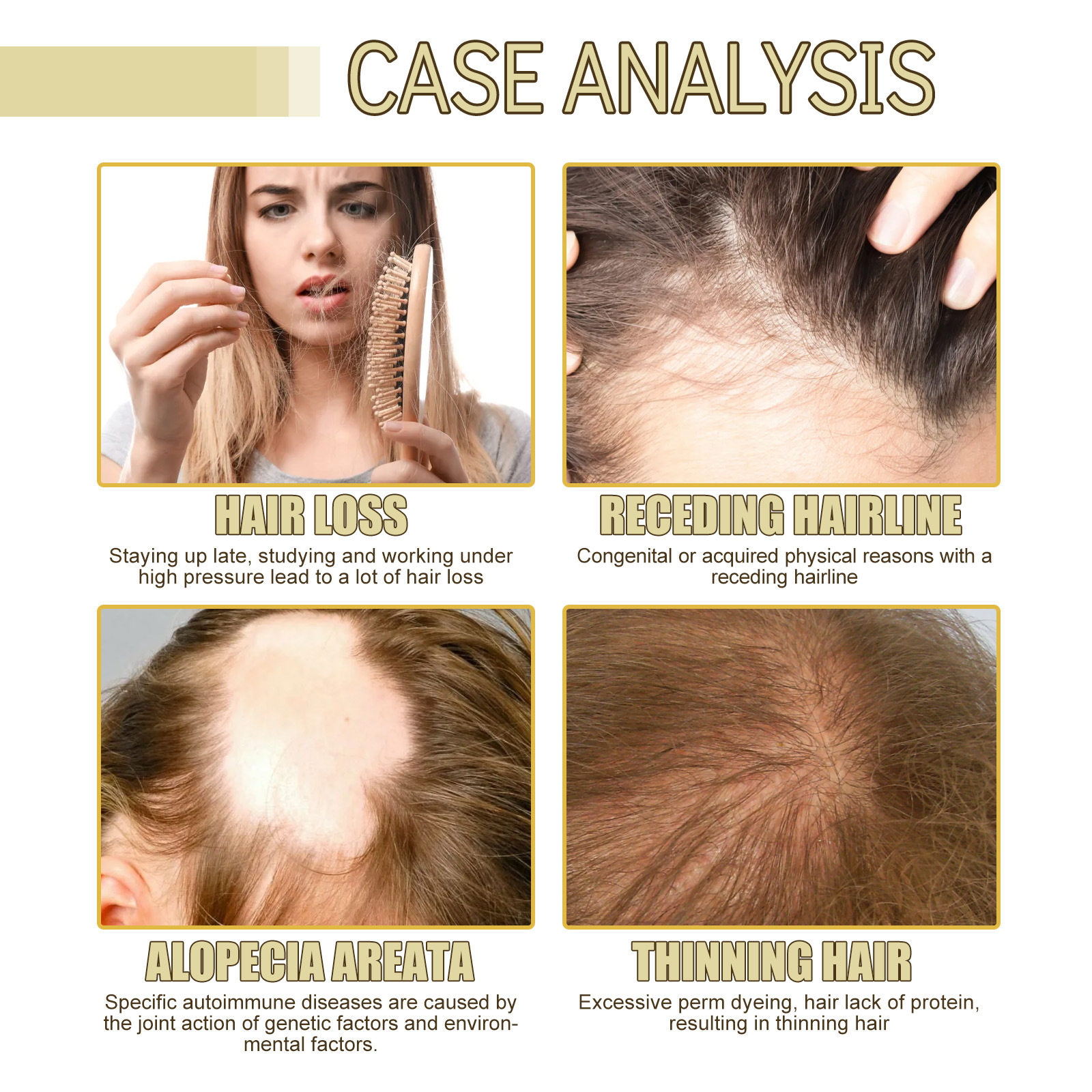 Rosemary Hair Oil Nourishing Smoothing Shine Enhancing For Soft Manageable Hair Daily Care