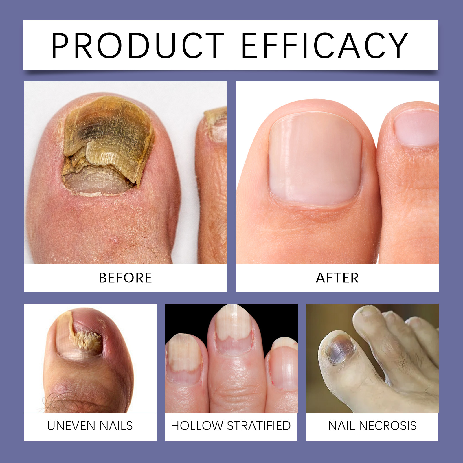 Nail Softening Care Liquid Nourish Nail Surface Moisturize Smooth Tender Mild Ingredient Comfort Natural Gloss Refreshing