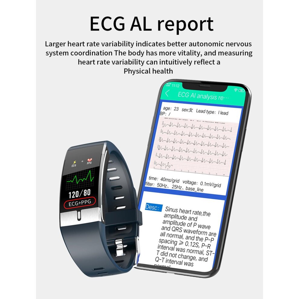 Smart Watch E66 Body Temperature ECG PPG Heart Rate Blood Fitness Tracker Bracelet Smart