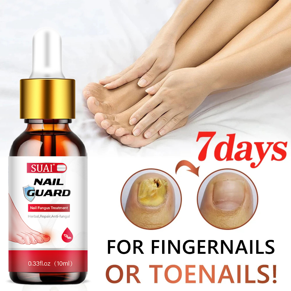 SUAI Nail Cuard Nail Fungal Treatment Herbal Essential Feet Repair Liquid Toe Nail Fungal Removal Anti Infection Paronychia Onychomycosis Tools 10ml