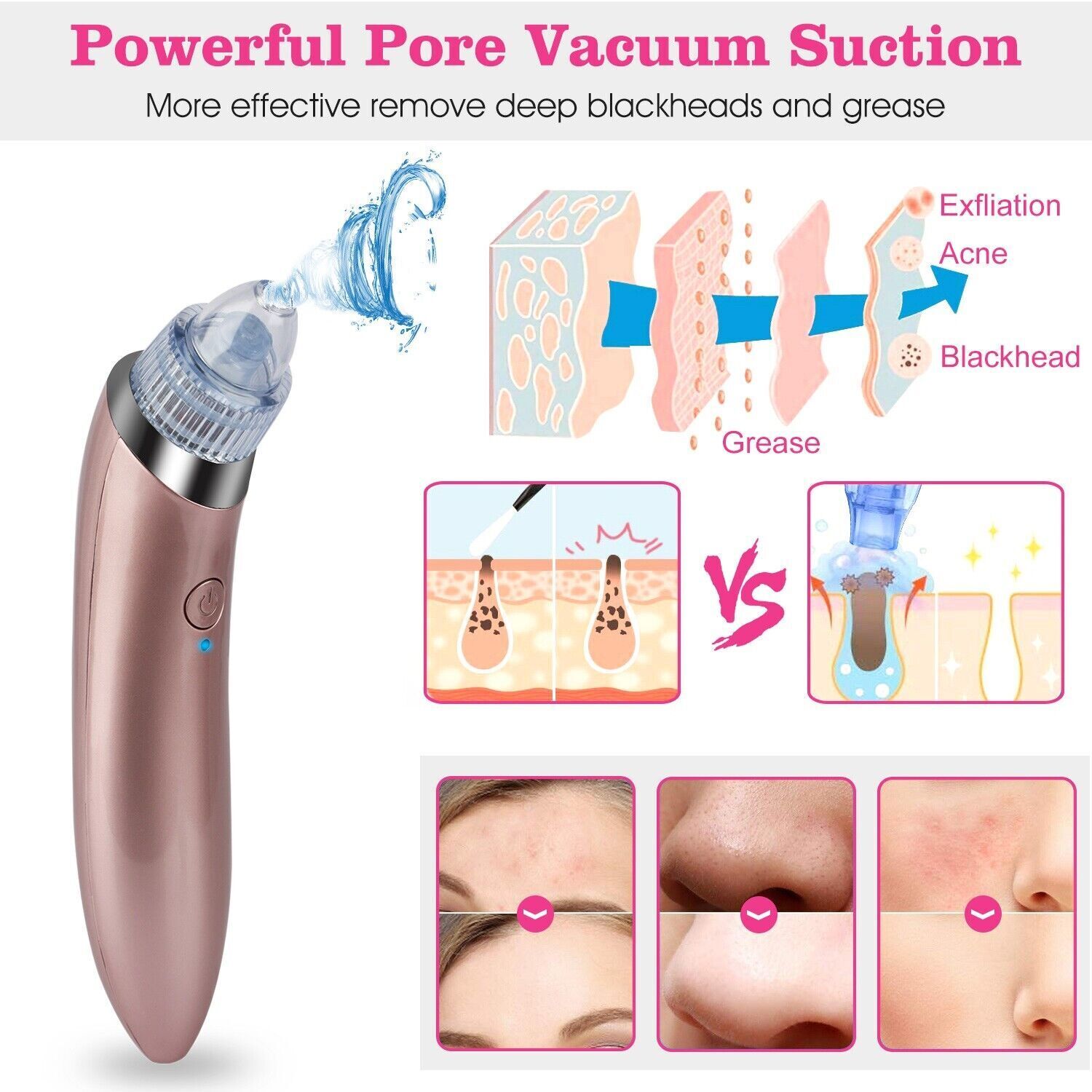 Electric Blackhead Remover Acne Cleaner Face Pore Vacuum Suction Skin Cleaning Tools Skin Care