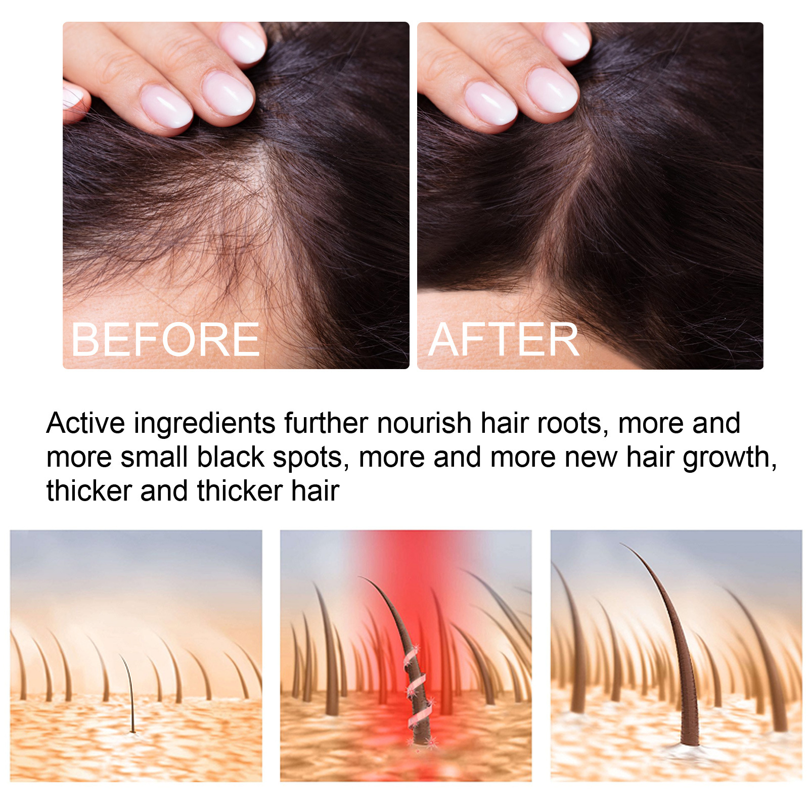 Ginger Hair Growth Spray Hair Thickening Serum Spray Hair Care Essential Oil Hair Root Care Liquid Anti Hair Loss