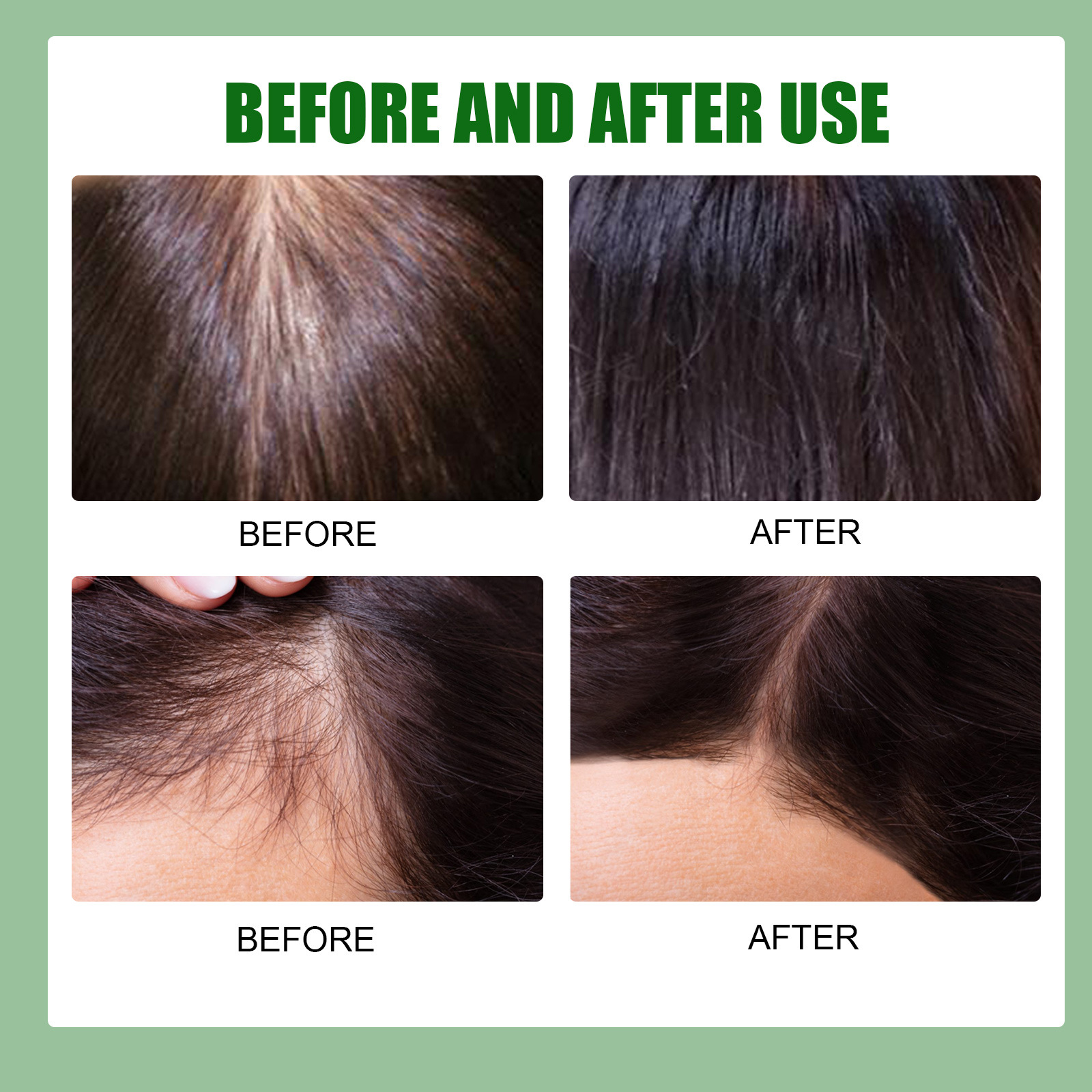 Ginger Hair Growth Spray Hair Thickening Serum Spray Hair Care Essential Oil Hair Root Care Liquid Anti Hair Loss