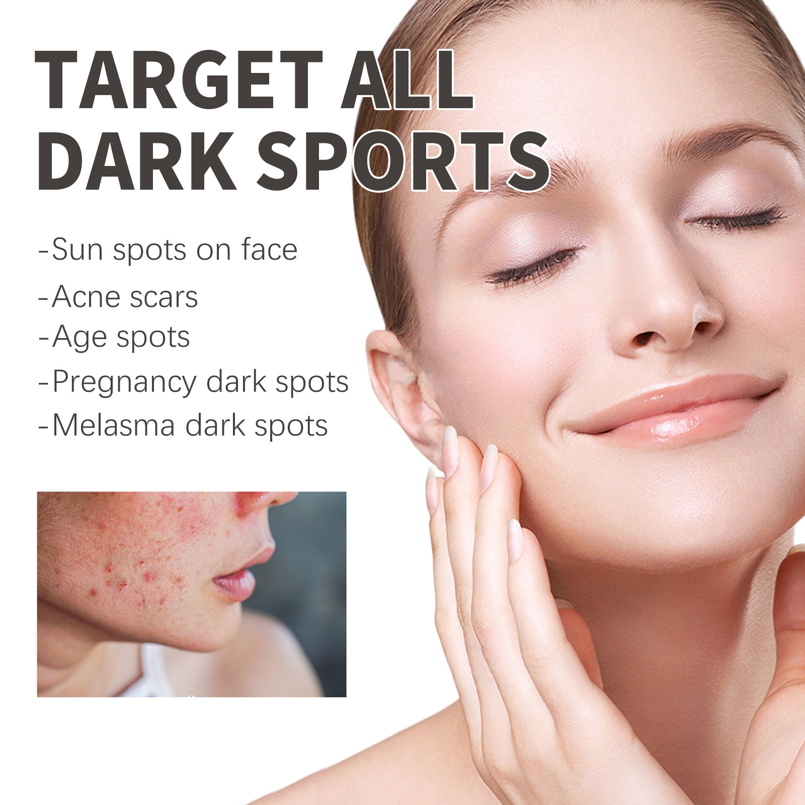 OUHOE Whitening Serum Remove Dark Sp-ots Pigm-entation Melasma Ac-ne Ma-rks Anti-aging Lift Firm Brightening Tender Skin Serum