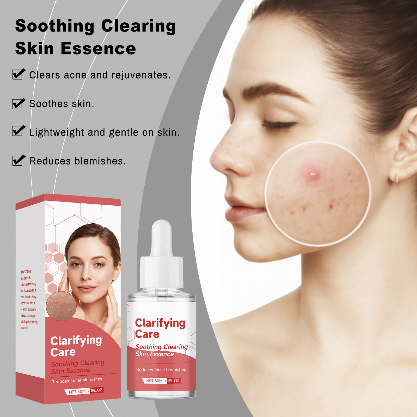 Acne Care Essence Liquid Mild Clean Skin Moisture Lock Water Refreshing Facial Pimple Clean Skincare
