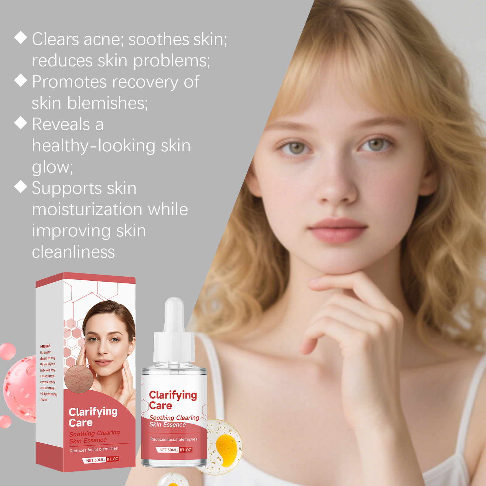 Acne Care Essence Liquid Mild Clean Skin Moisture Lock Water Refreshing Facial Pimple Clean Skincare