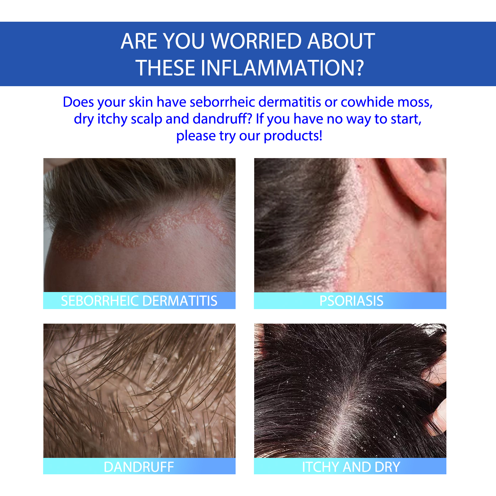 Scalp Skin Care Balm Soothing Cream For Sensitive Scalp And Skin Irritation Gentle Head Face Body Care