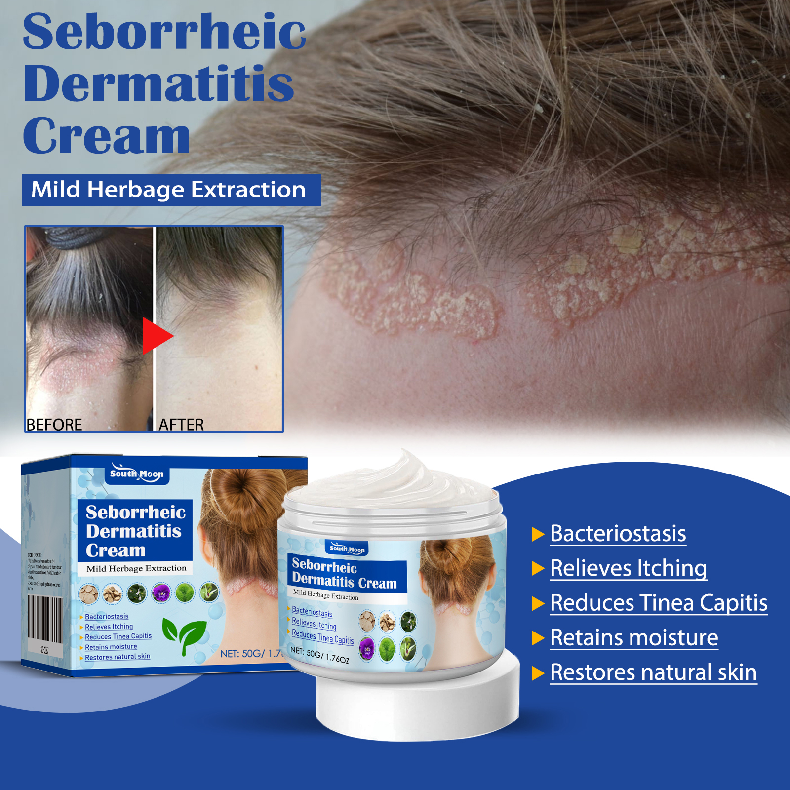 Scalp Skin Care Balm Soothing Cream For Sensitive Scalp And Skin Irritation Gentle Head Face Body Care