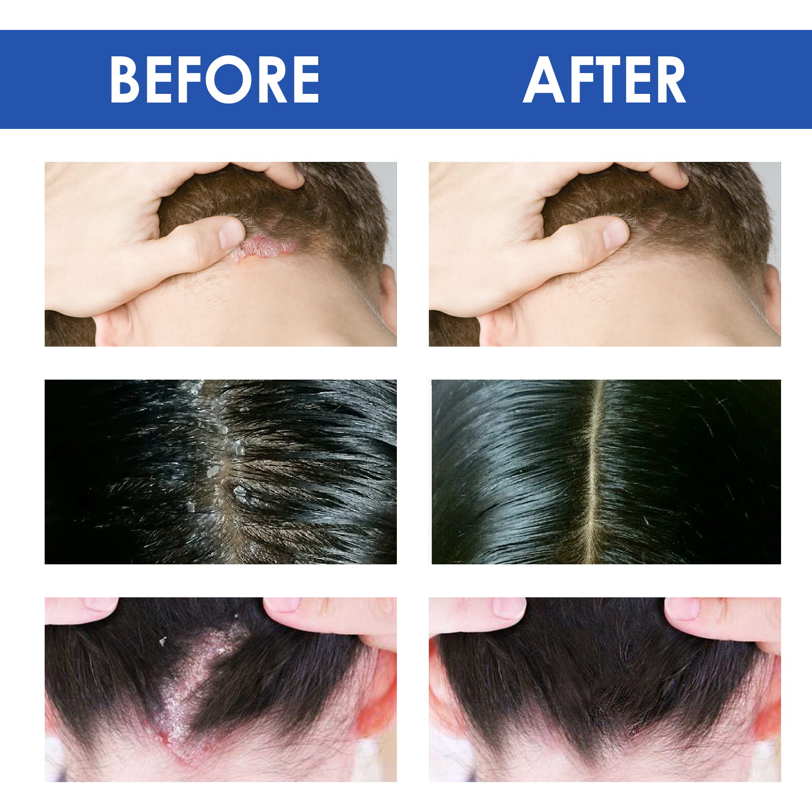 Scalp Skin Care Balm Soothing Cream For Sensitive Scalp And Skin Irritation Gentle Head Face Body Care