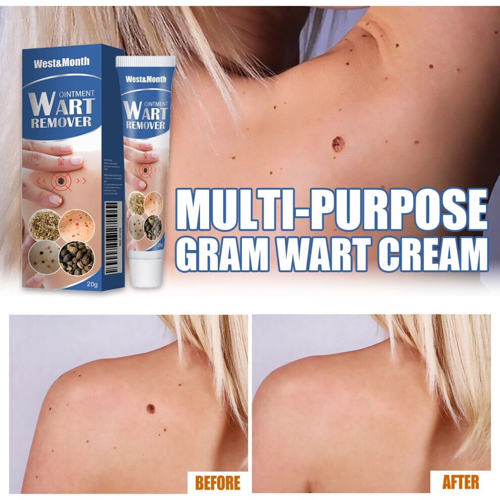 WART REMOVER OINTMENT SKIN TAG NATURAL TREATMENT MOLES SAFE VERRUCA 20g