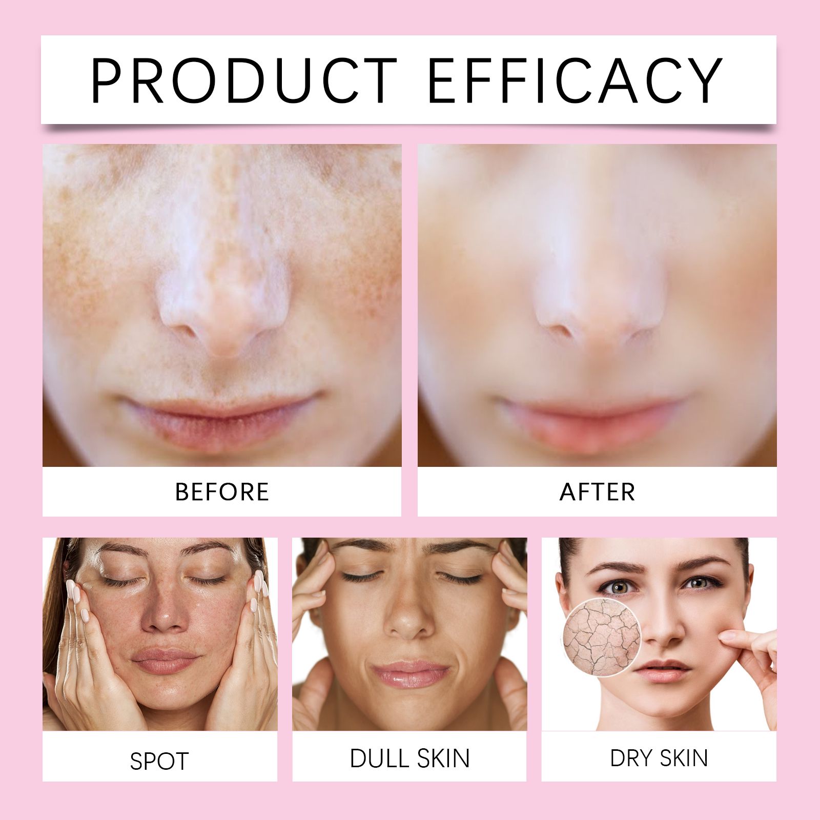 Kojic Acid Moisturizing Cream Hydrating Nourishing For Face Skin Barrier Daily Care