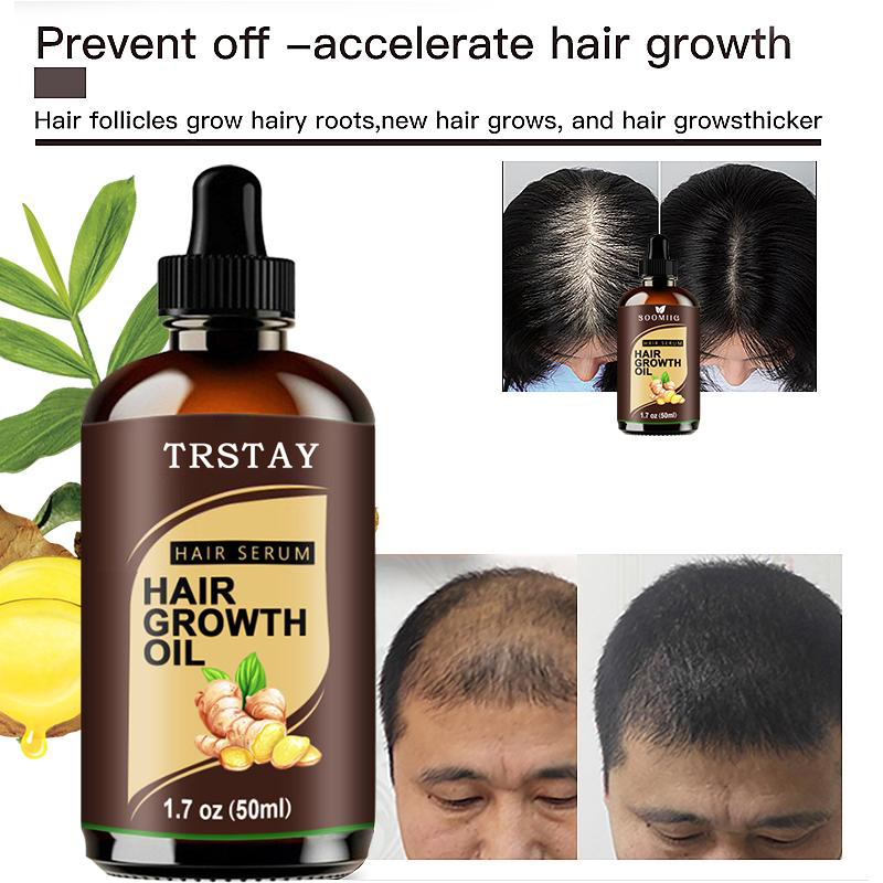 (15ml) Powerful Hair Growth Oil Prevent Hair Loss Products Essence Liquid Treatment For Men And Women Repair Shampoo Hair Care
