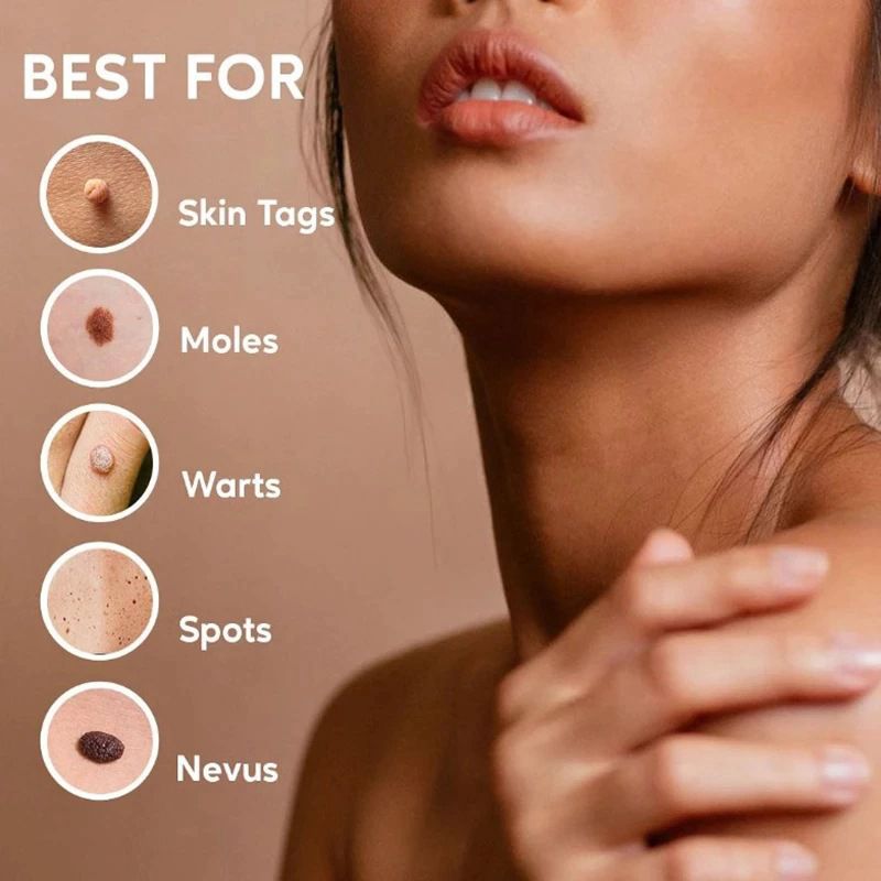 iBeaLee Skin Tag Remover Tagwort Removal 7 Days 5ml