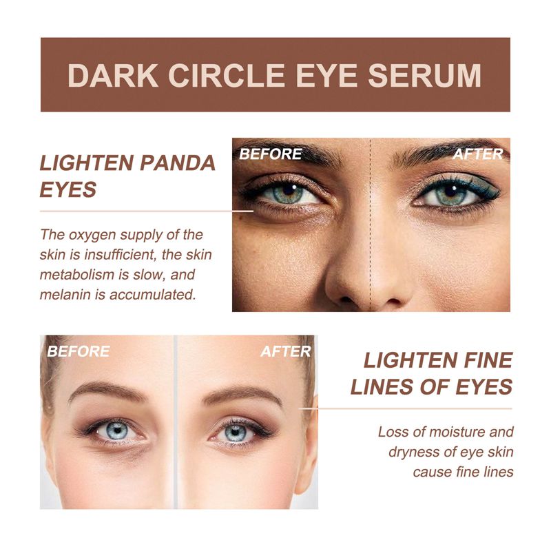 Dark Circle Anti-aging Rapid Reduction Eye Serum 20ml
