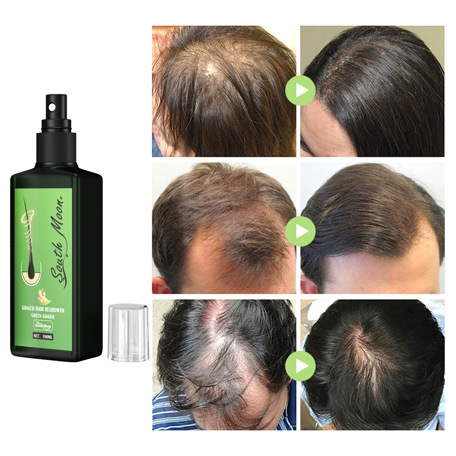 Hair Lotion Serum Essence Nourishing Ginger Spray Liquid Organic Growth Hair Growth Hydrating Anti Hair Loss Treatment for Men Women