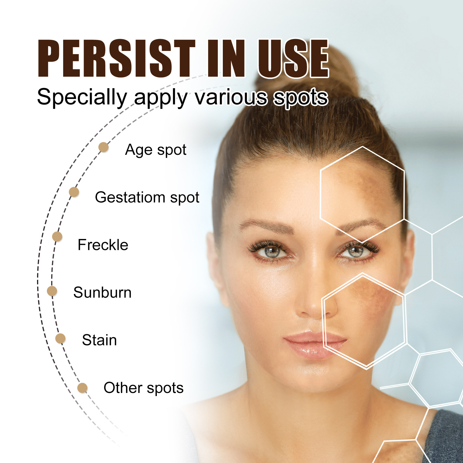 Freckle-Removing Cream Spot Off Freckle Whitening Fades Spots and Brightens Skin Tone Dark Spot Remover Moisturizing Skin Care