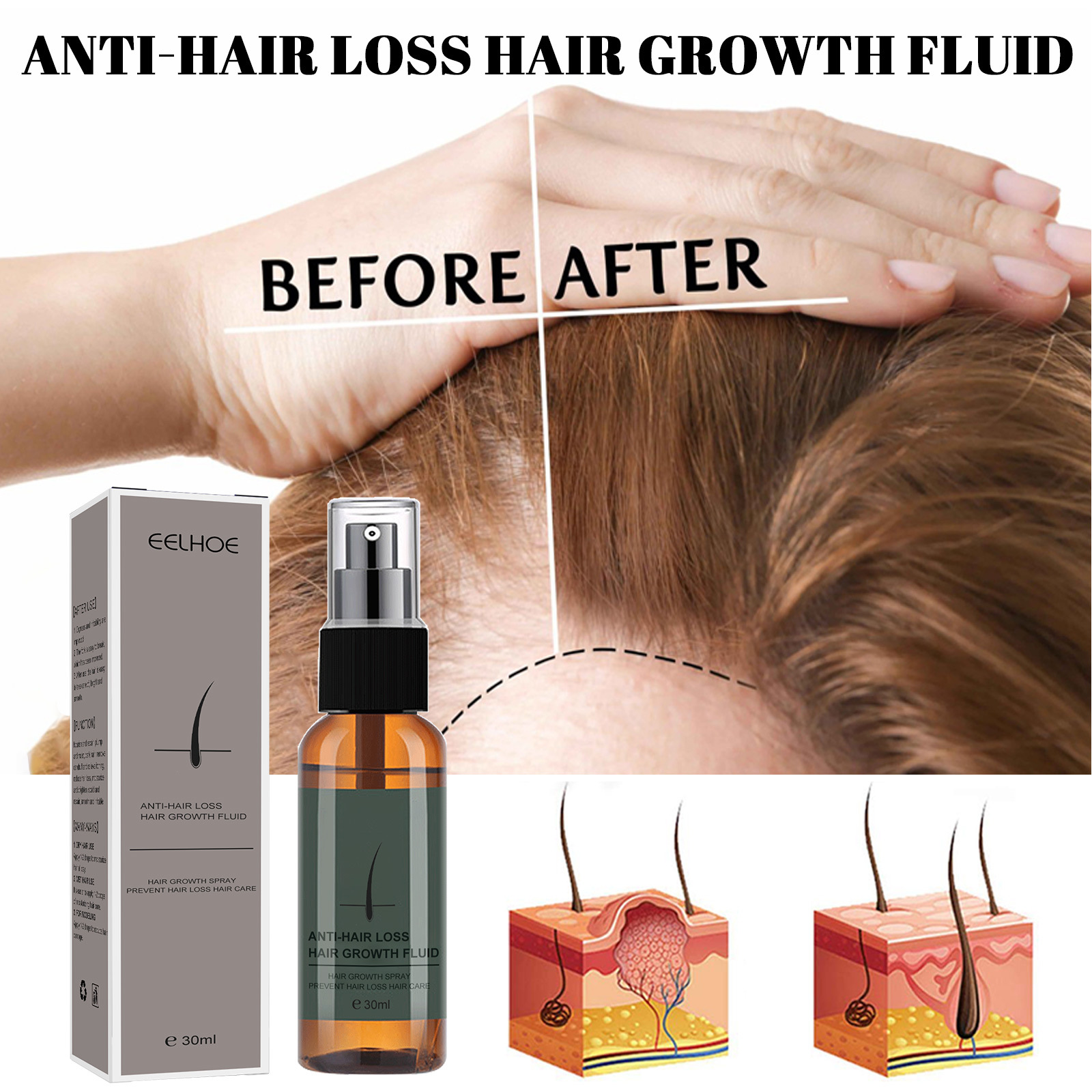 Hair Growth Essential Oil Essence Original Authentic Prevent Hair Loss Liquid Care Beauty Hair Growth Spray Hair Care Serum 30ml