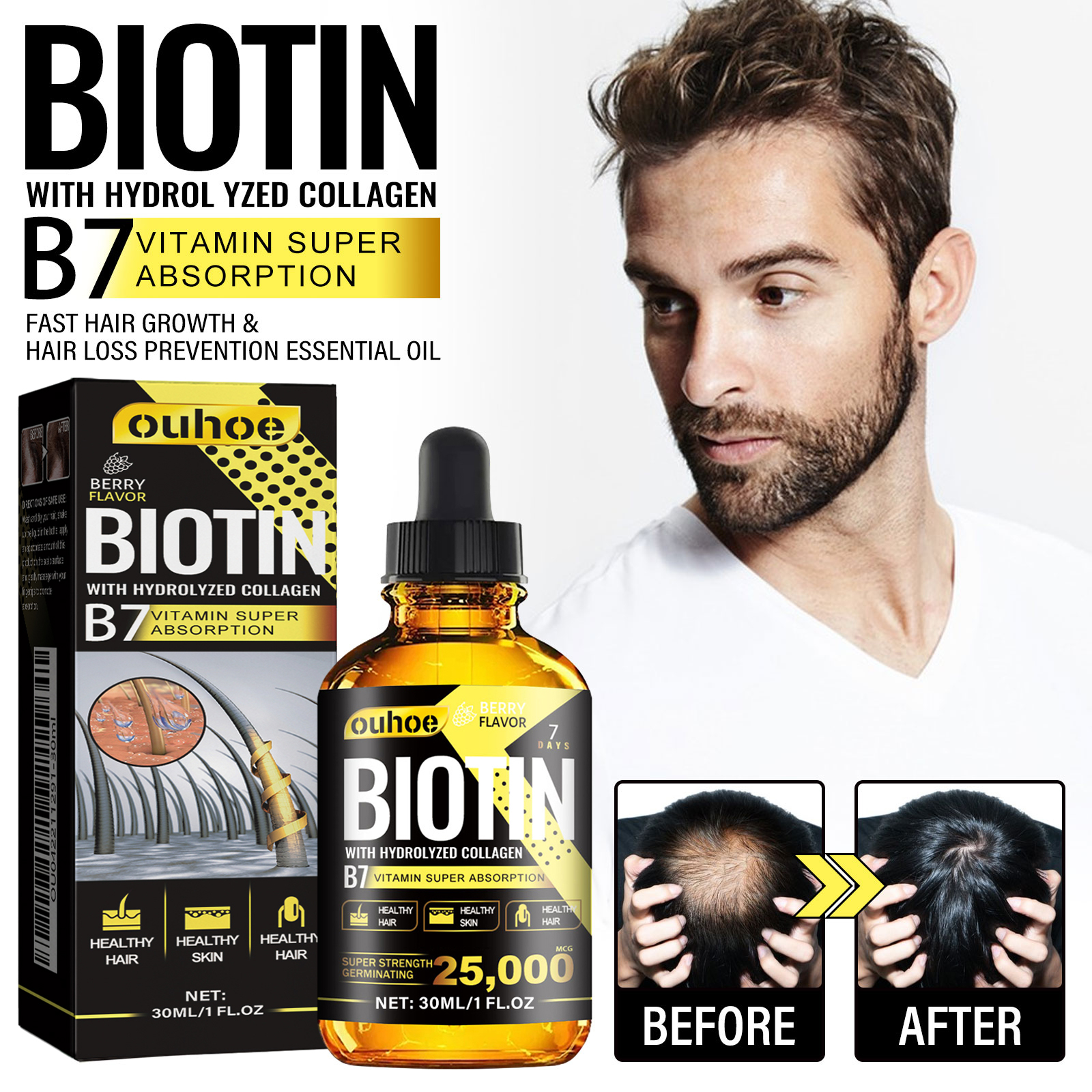 3Pcs Collagen B7 Vitamin Hair Growth Essential Oil Prevent Hair Loss And Nourish With Essential Oil Scalp Treatment Set For Men Women