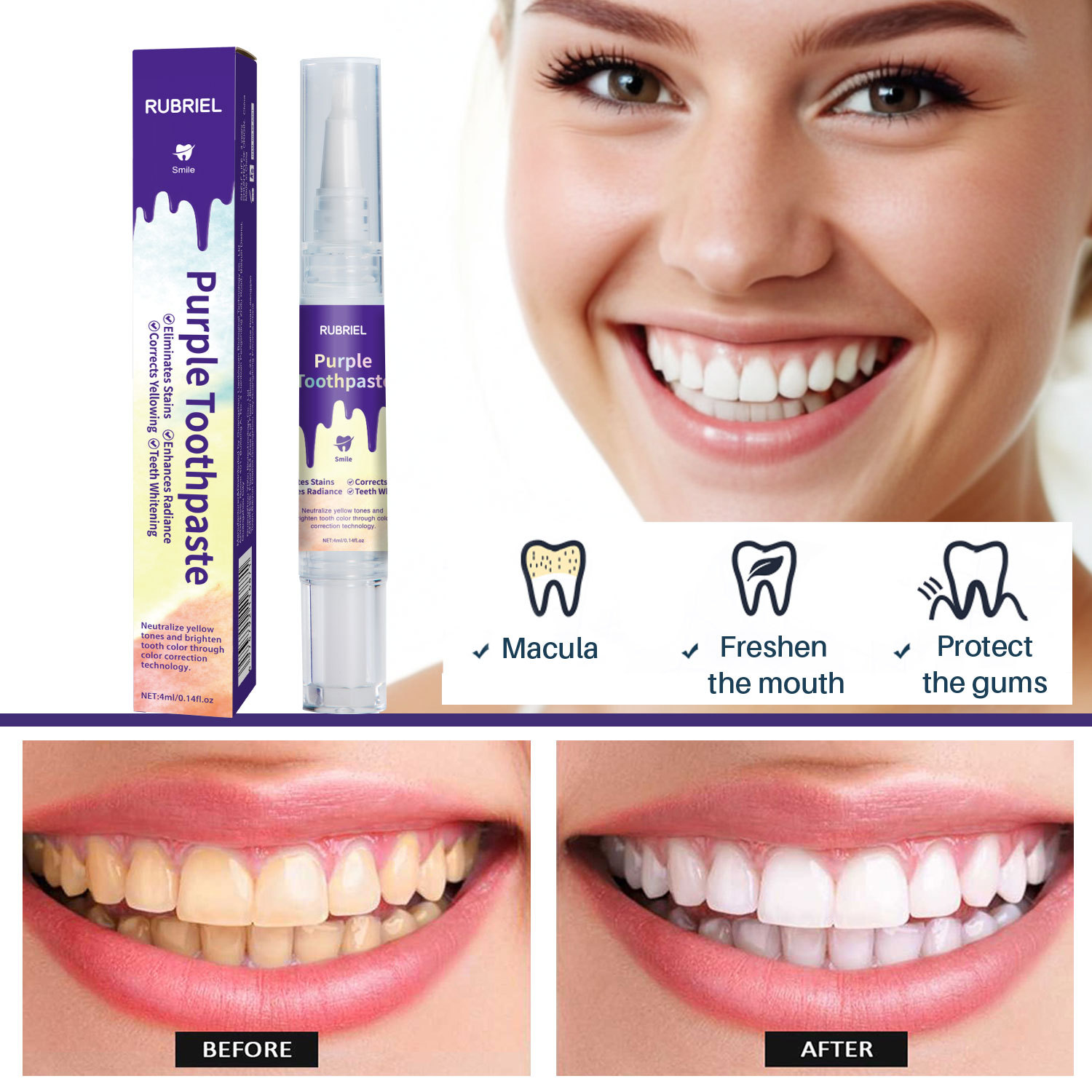 V34 Rotary Teeth Whitening Pen For Stain Removal Breath Freshening And Daily Oral Care Travel Portable Whitening Tool 4ml