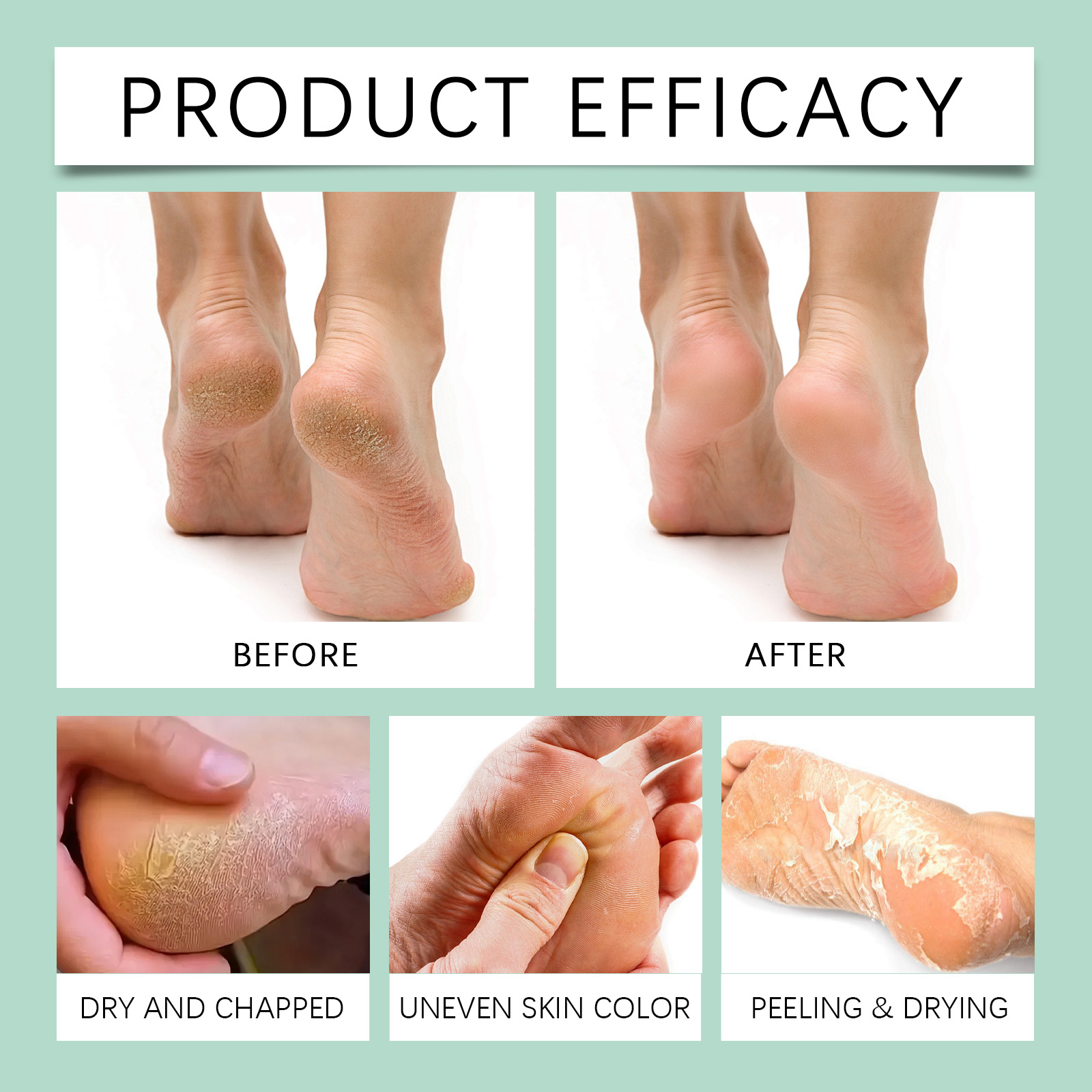 Nicotinamide Foot Care Cream Guard Epidermis Moisturize Tender Elastic Hydrate Radiant Daily Tissue Keep Silky
