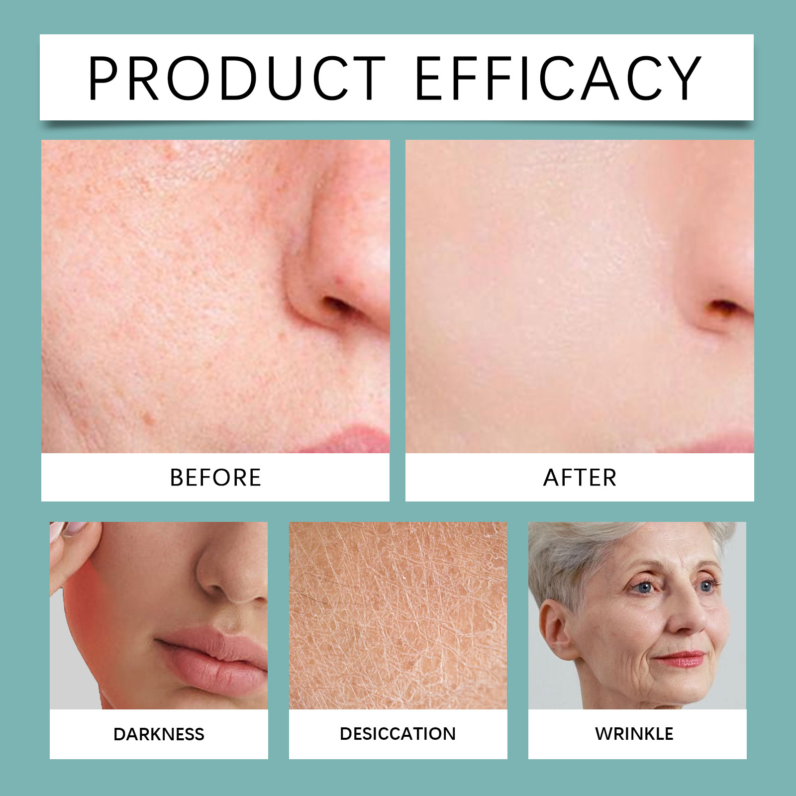 Skin Care Patch Mild Clean Smooth Breathable Soft Material Face Body Acne Spot