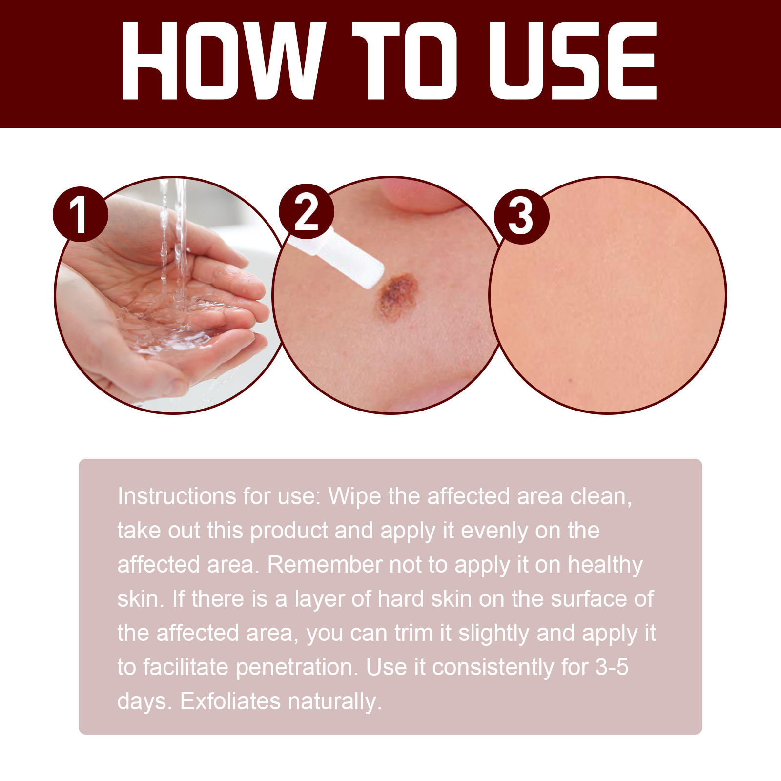 Body Care Pen Skin Tag Remover Cleansing Warts Corns Softening Keratin For Smooth Skin Daily Treatment
