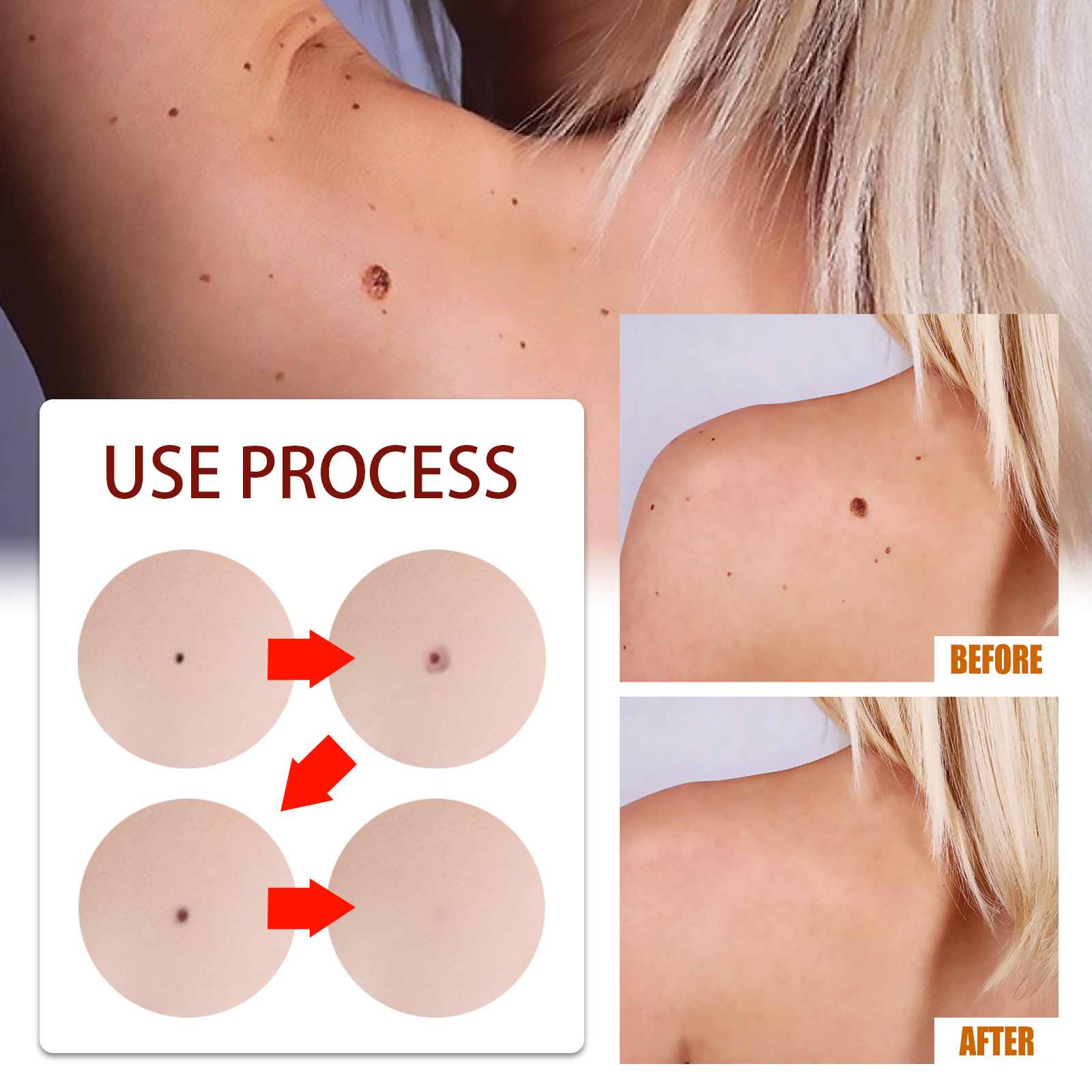 Body Care Pen Skin Tag Remover Cleansing Warts Corns Softening Keratin For Smooth Skin Daily Treatment