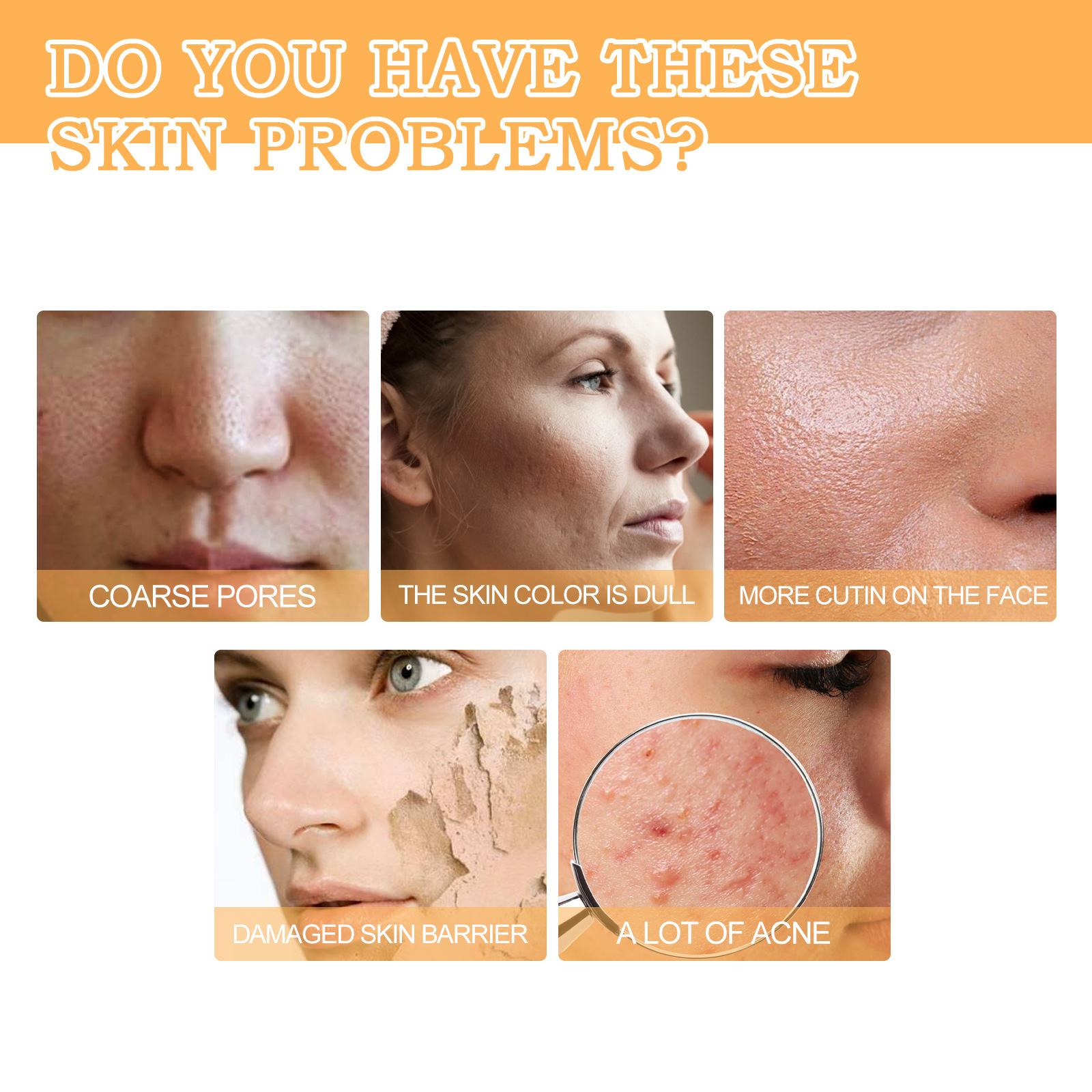 Face Toner for Women Glycolic Acid 7 Percent Toning Resurfacing Solution Improve Blemishes Remove Acne Marks Skin Care