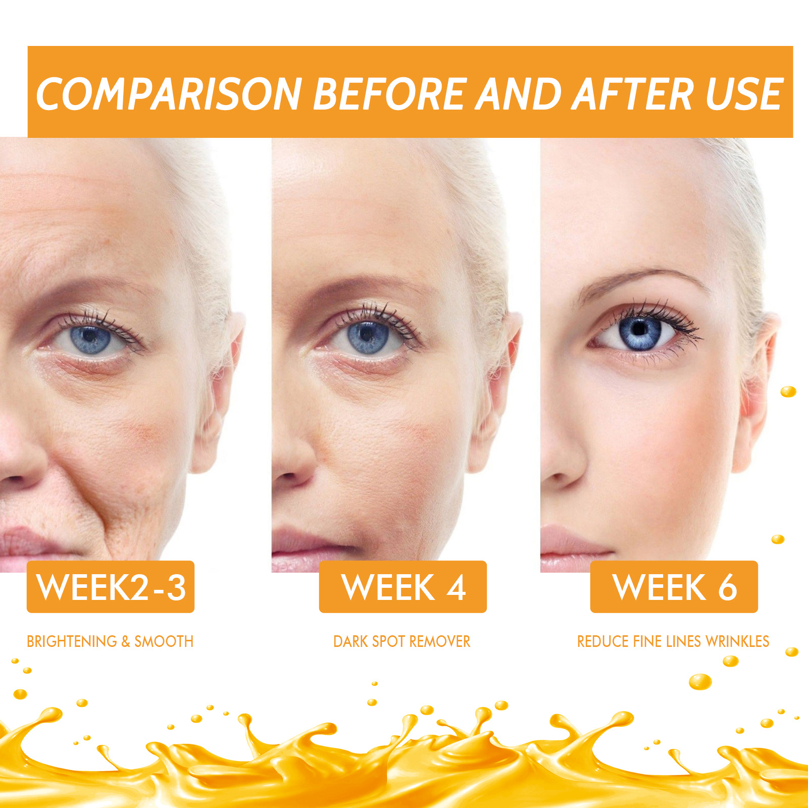 OUHOE Vitamin C Whitening Face Serum Remove Dark Spots Freckles Fade Melanin Retinol Anti-wrinkle Essence Brightening Beauty Skin Care