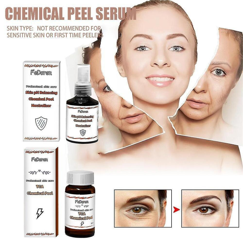 Tca 30 Percents  Tca Peel Acid Peeling Acid Skin Superforce Peeling Pigmentation Acne Scar