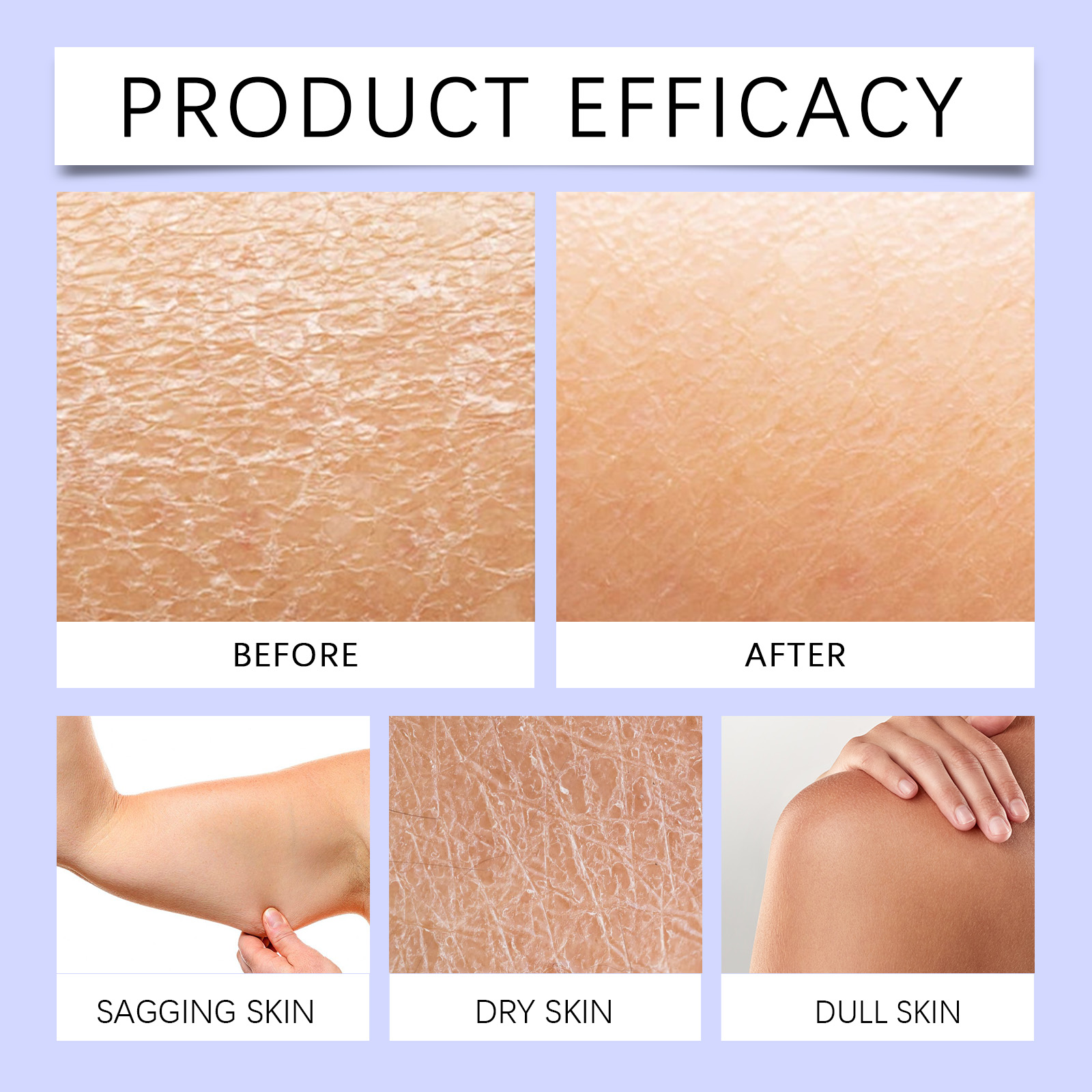 Hyaluronic Acid Moisturizing Cream Mild Hydrating Nourish Soft Tender Daily Care For Gentle Body Skin Care