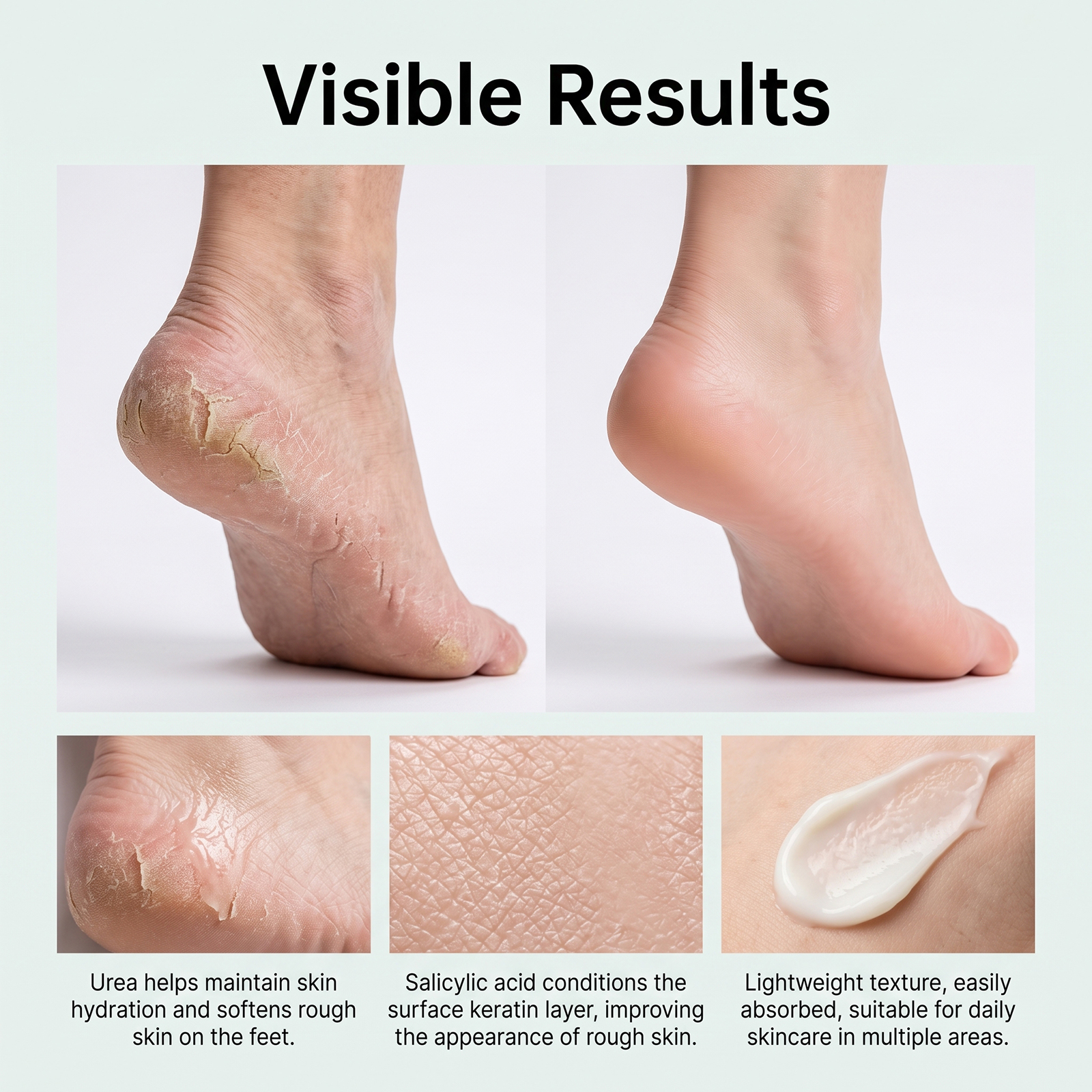 Urea Foot Cream Light Texture Hydrating Non Sticky Deep Moisturizing Smooth Delicate Softens Rough Foot Skin