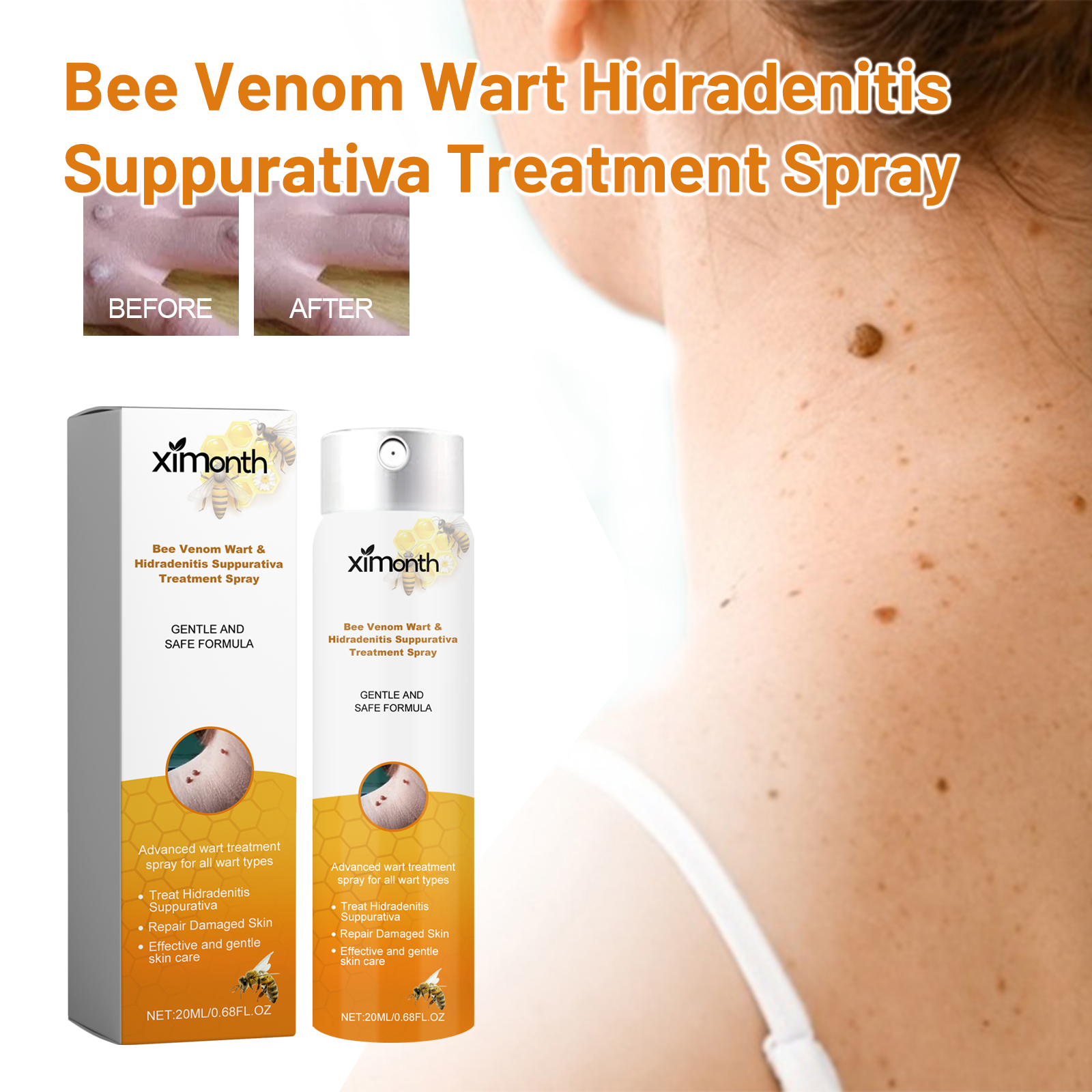 Bee Venom Skin Tag Remover Spray Cleansing And Repairing For Warts And Corns Daily Care Treatment 1 PCS