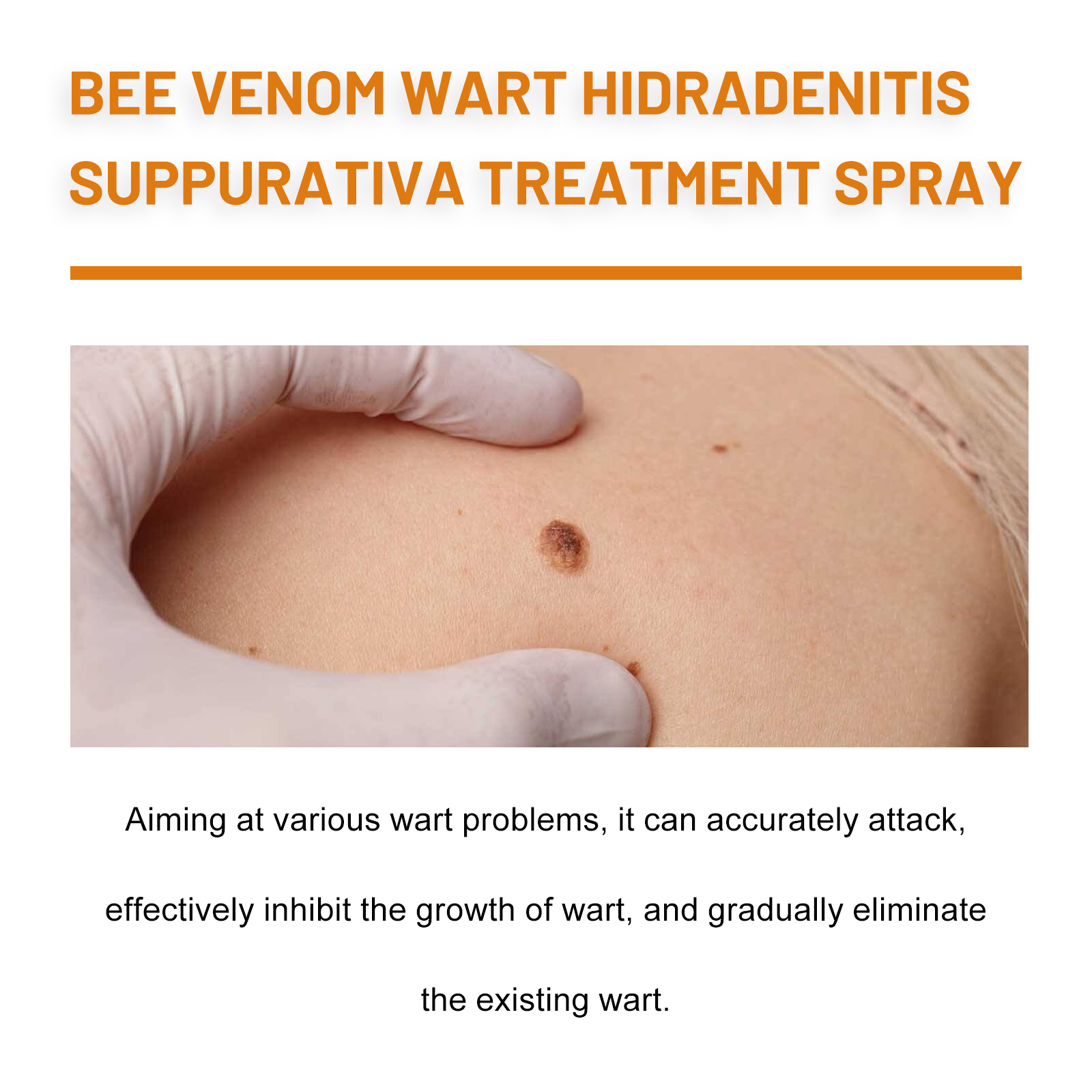 Bee Venom Skin Tag Remover Spray Cleansing And Repairing For Warts And Corns Daily Care Treatment 1 PCS