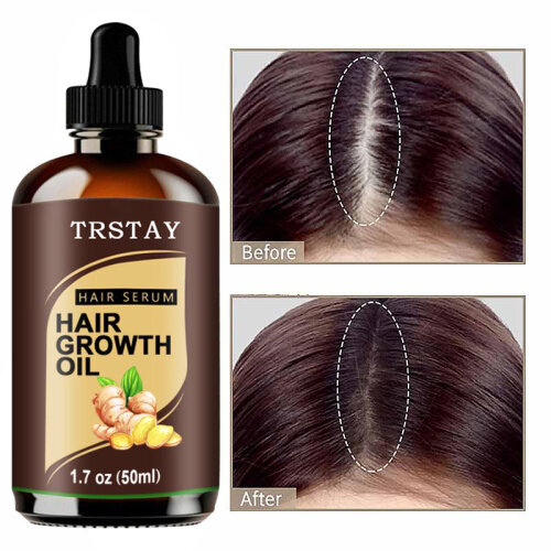 Powerful Hair Growth Oil Prevent Hair Loss Products Essence Liquid Treatment For Men And Women Repair Shampoo Hair Care