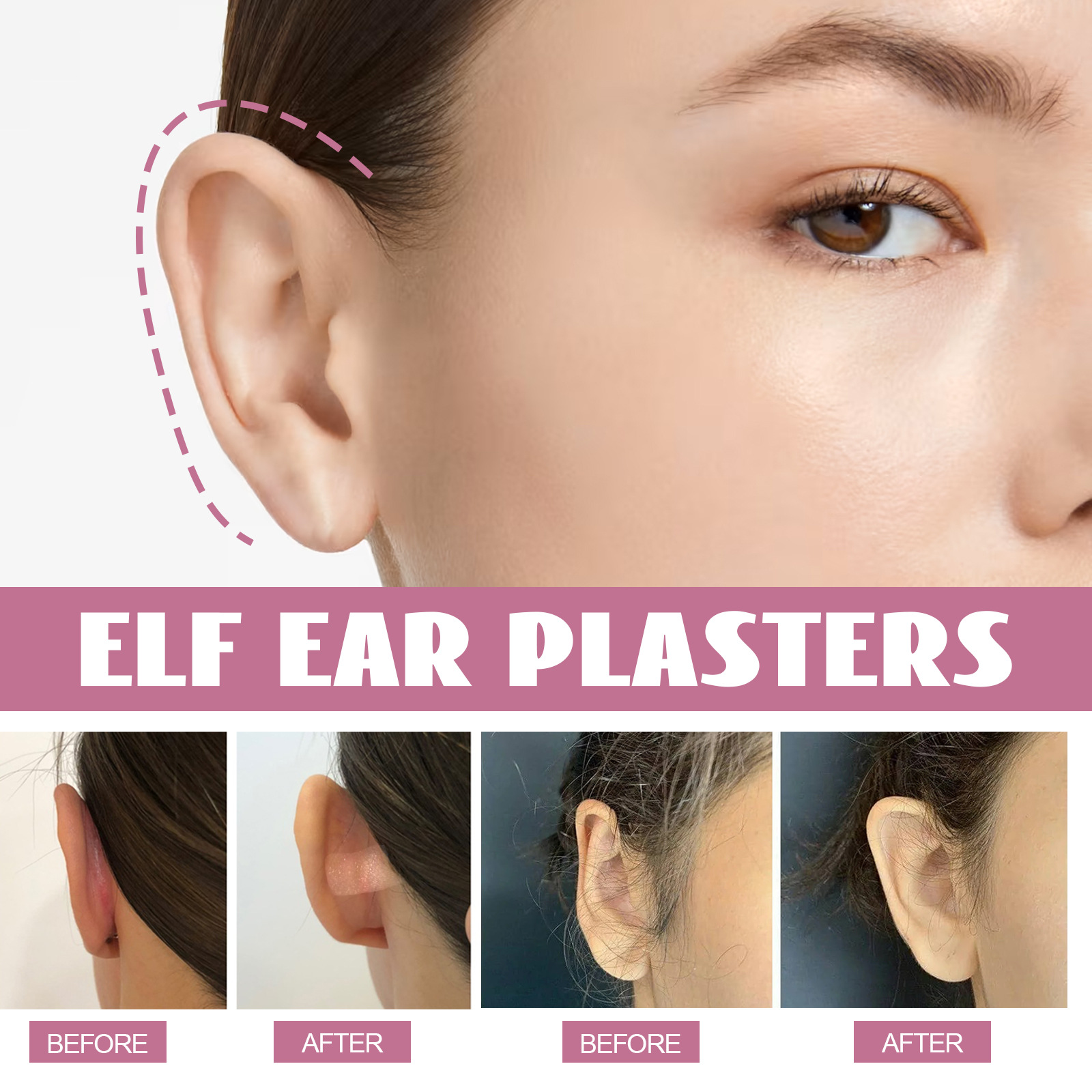 Elf Ear Plasters Cosmetic Protruding Ear Stickers Invisible Protruding Ears Correctar Tap Women Solution Big Ear Supporters Aesthetic Corrector Tools