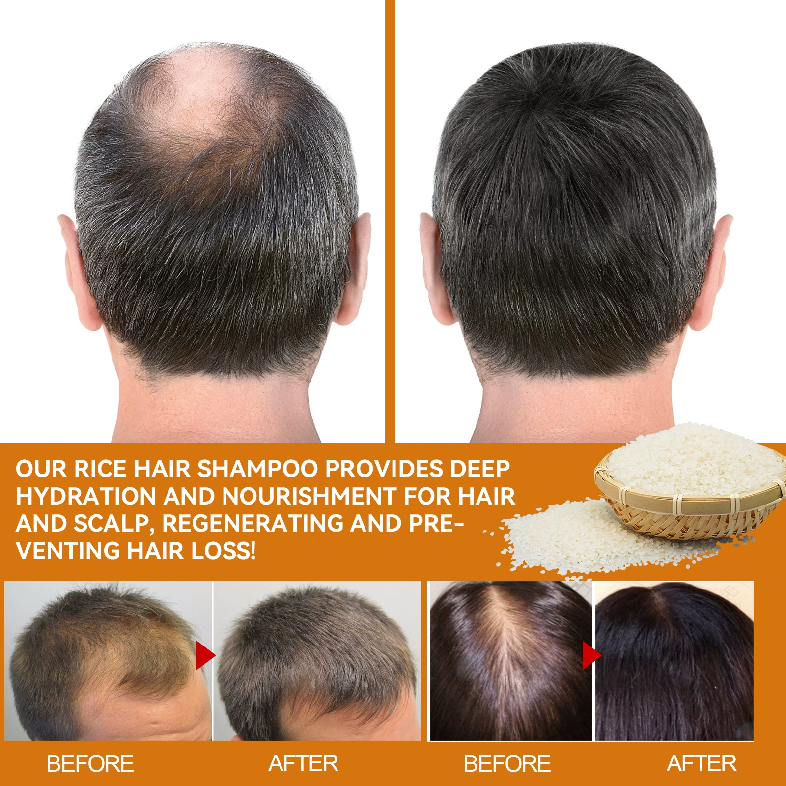 Rice Water Hair Growth Shampoo 100ml