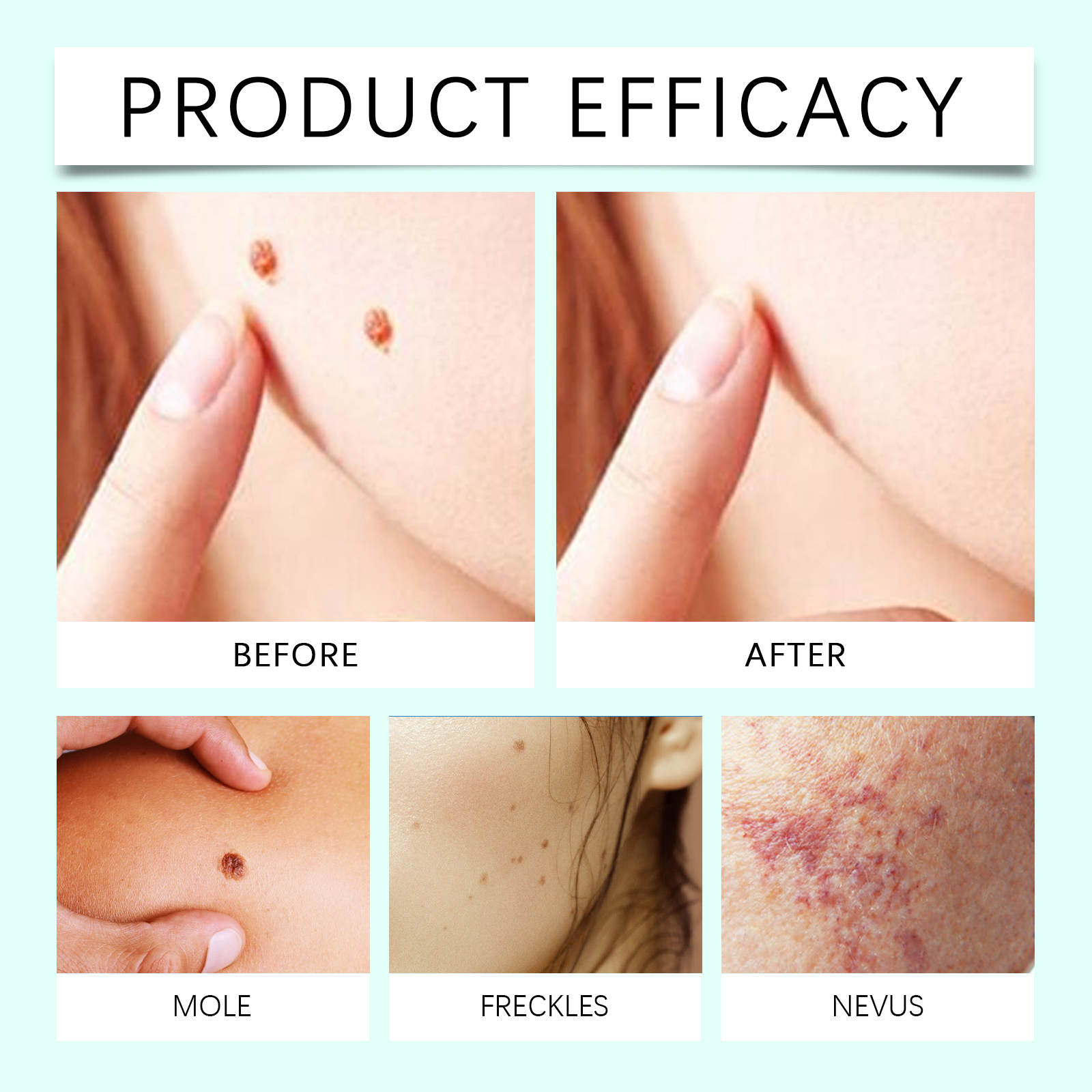 Skin Care Patches Gentle Skin Friendly Comfortable Smooth Local Body Skin Daily Care