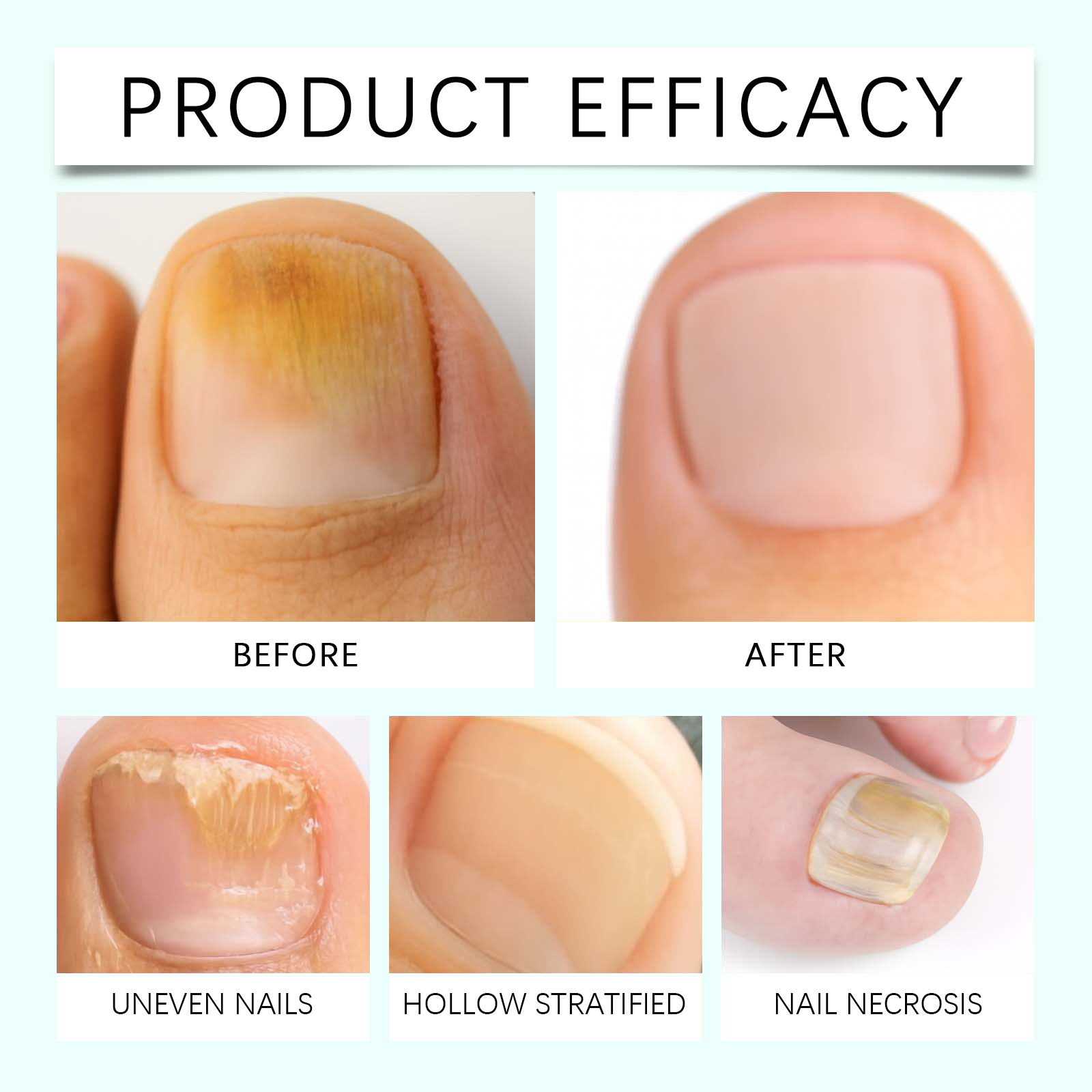 Nail Care Pen Daily Cleaning Nail Glossy Surface Mild Moisturizing Hand Foot Nail Softening Care Pen