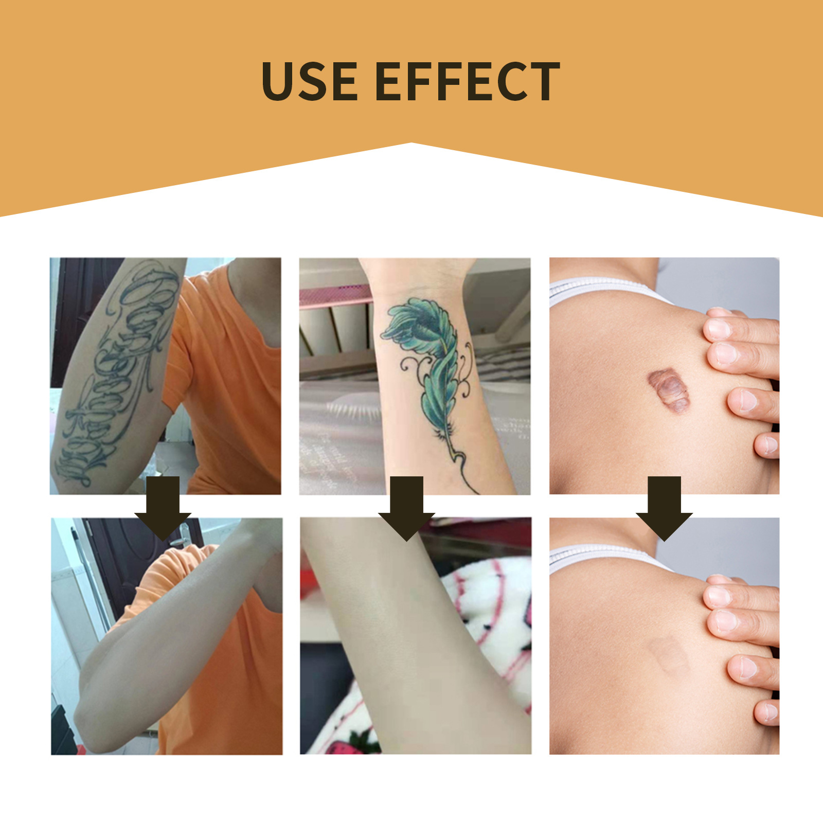 (1 PC) Tattoo Concealer Patches Ultra Thin Patch For Tattoo Scar And Birthmarks Conceal Skin Color Invisible Waterproof Skin Tone Concealer Sticker For Covering