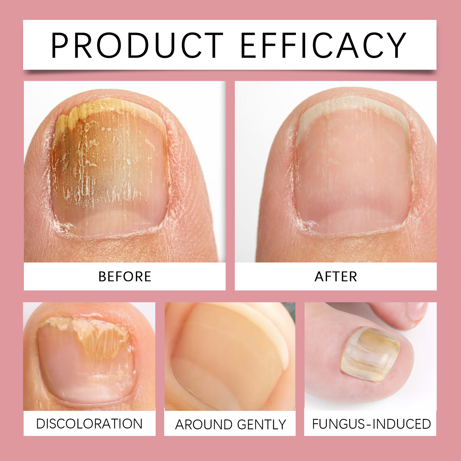 Nail Care Essence Gentle Moisturizing Mild Protect Refreshing Fast Absorb Fine Glossy For Nail Surface Finger Nails