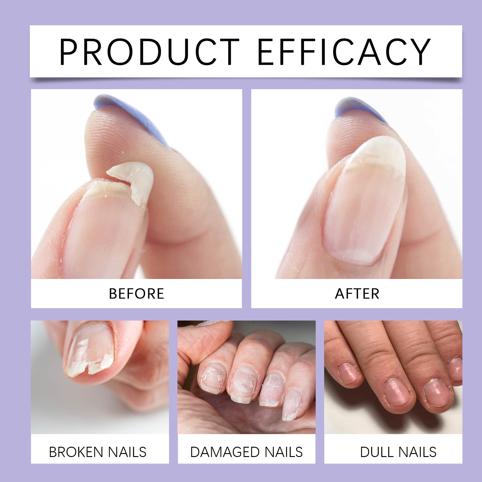 Nail Care Patches Gentle Care Soften Cuticles Moisturize Smooth Damaged Nails Daily Maintenance