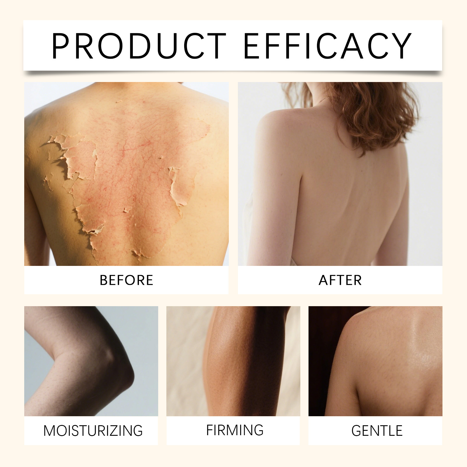 Bee Venom Multi-effect Care Cream Mild Comfort Tender Body Skin Refreshing Non-sticky Moisturizing Delicate Skin