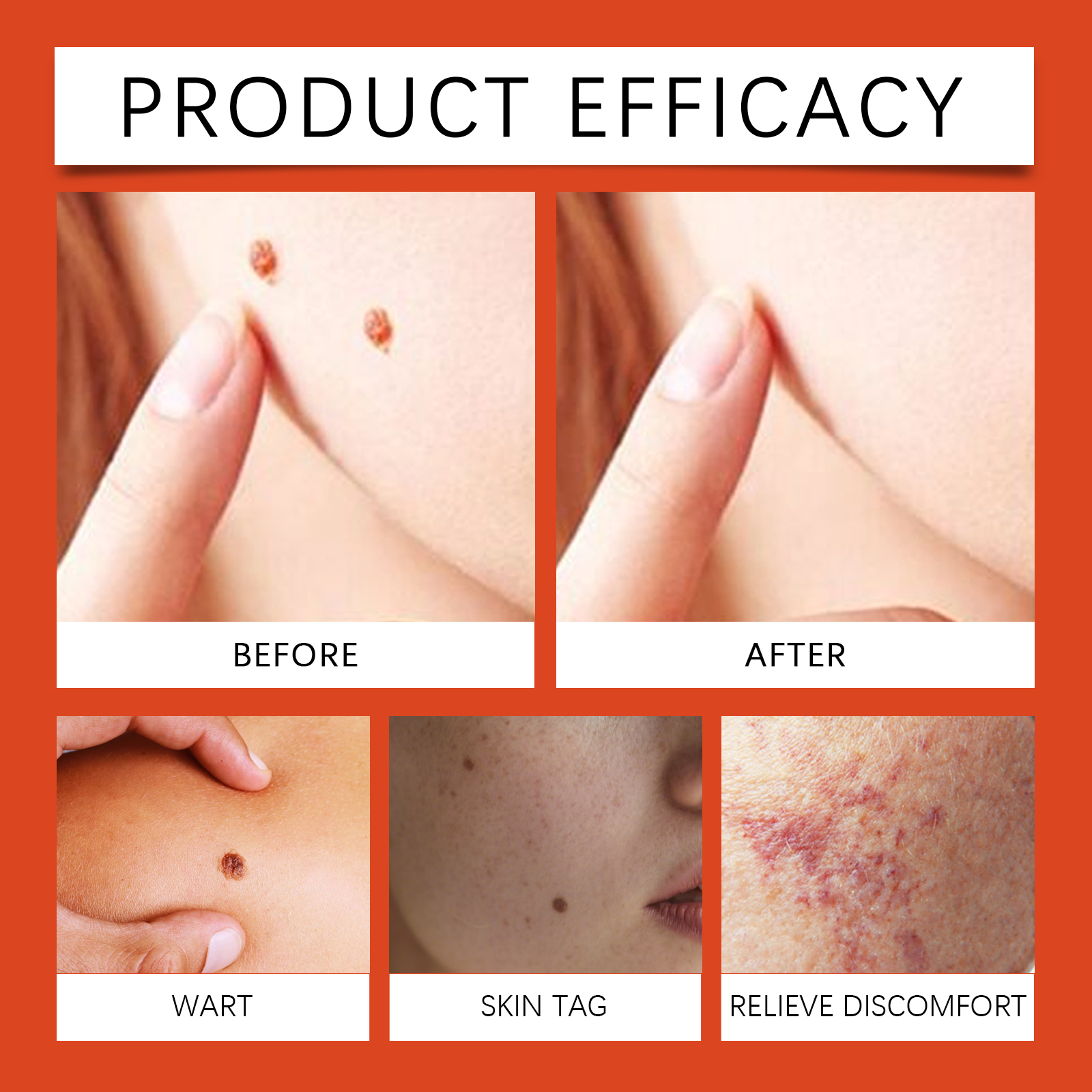 Bee Venom Care Cream Mild Formula Nourishes Skin Tenderly Protects Smooth Refreshing Easy Smear Body Care Lotion