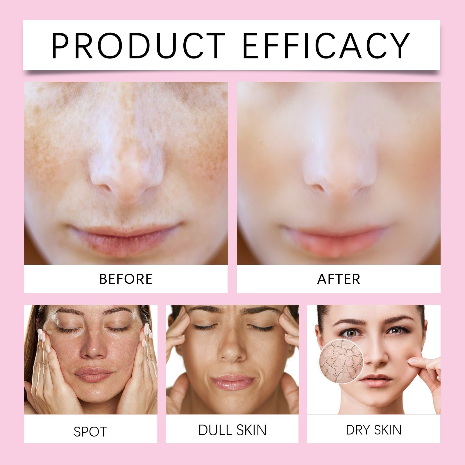 Kojic Acid Moisturizing Cream Protect Delicate Facial Skin Brighten Complexion Lock Moisture Nourish Complexion