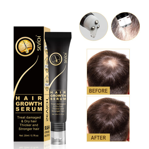 Sevich Hair Growth Oil Ginger Extract Growing Serum Prevent Hair Loss Care Scalp Massage Roller Treatment Thickener Essence 20ml