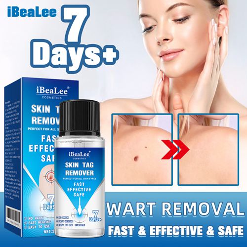 iBeaLee 20ml Skin Tag Remover Fast Effective Safe