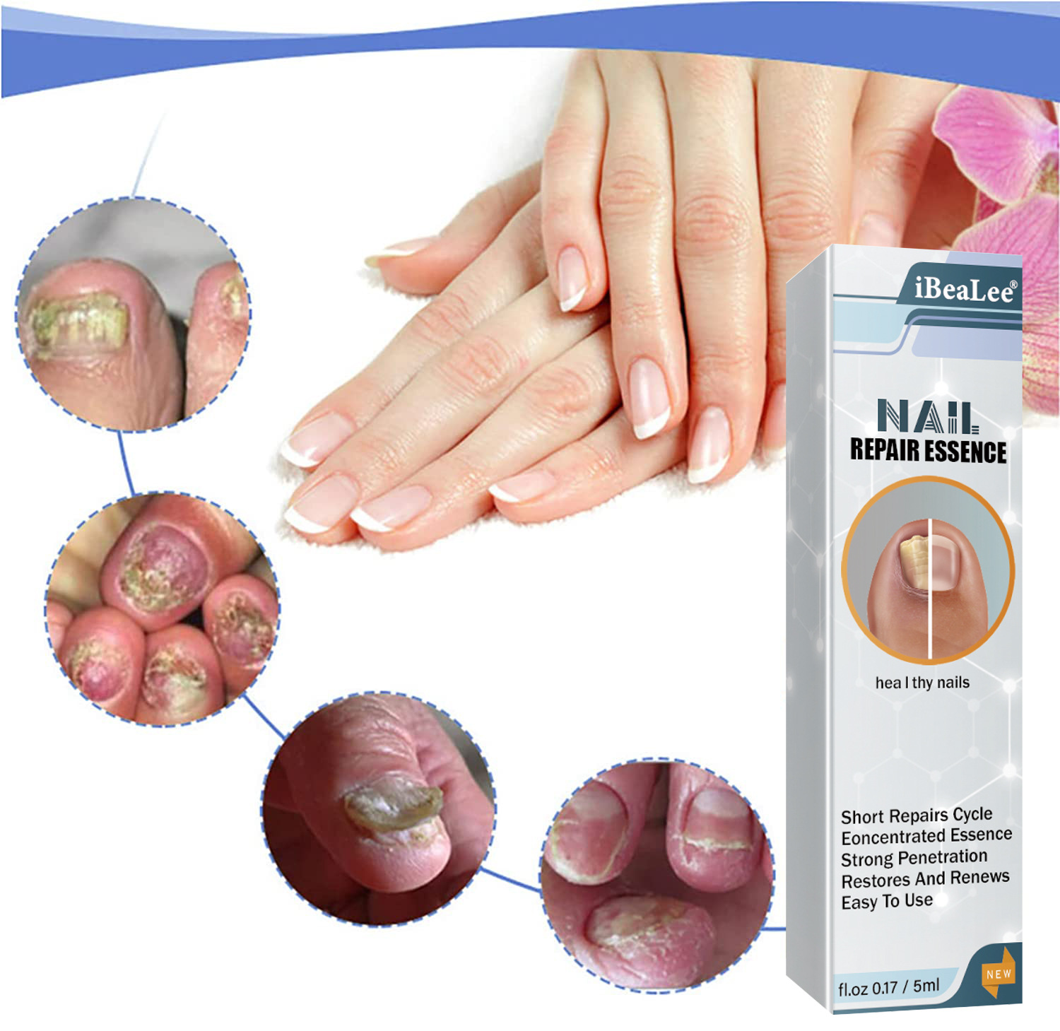 iBeaLee Nail Repair Essence Fungus Treatment Pen Fungus Stop Pen Toenail and Nail Care Solution